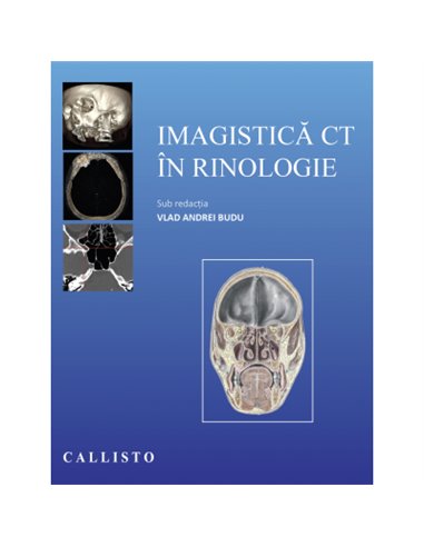 Imagistica CT in Rinologie - Vlad Andrei Budu  Editura Callisto