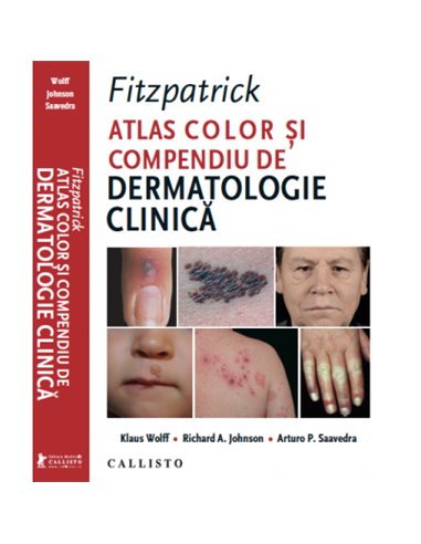 Fitzpatrick, Atlas Color si Compendiu de Dermatologie Clinica - Klaus Wolff | Editura Callisto